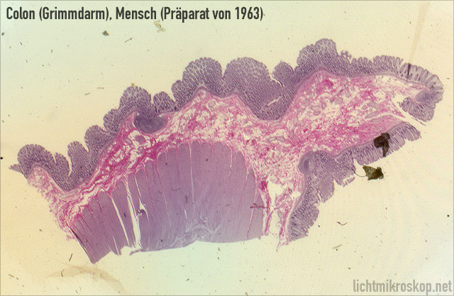 Mikroskopieren: Colon-Ausschnitt