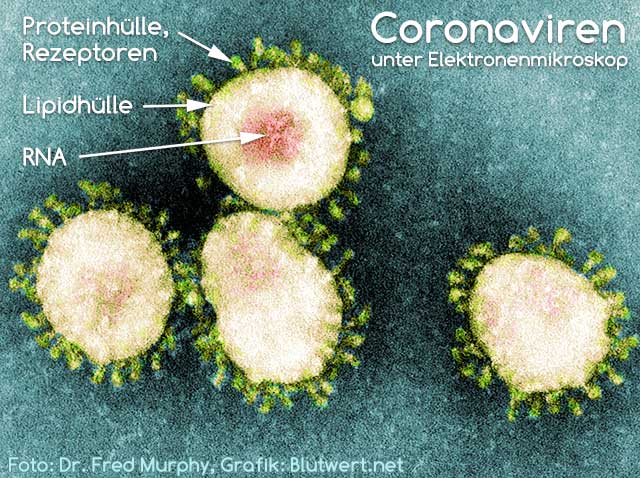 Coronavirus unter einem Elektronenmikroskop