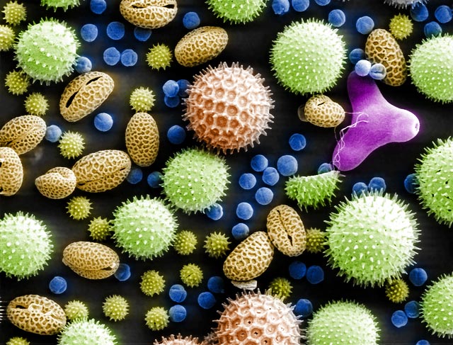 Rasterelektronenmikroskopie: Pollen